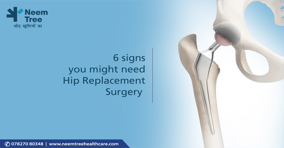 6 signs you might need Hip Replacement Surgery