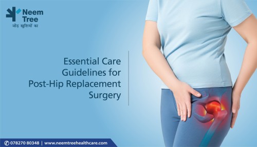 Essential Care Guidelines for Post-Hip Replacement Surgery