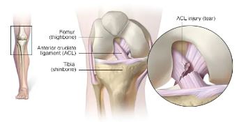 best total knee replacement in West Delhi