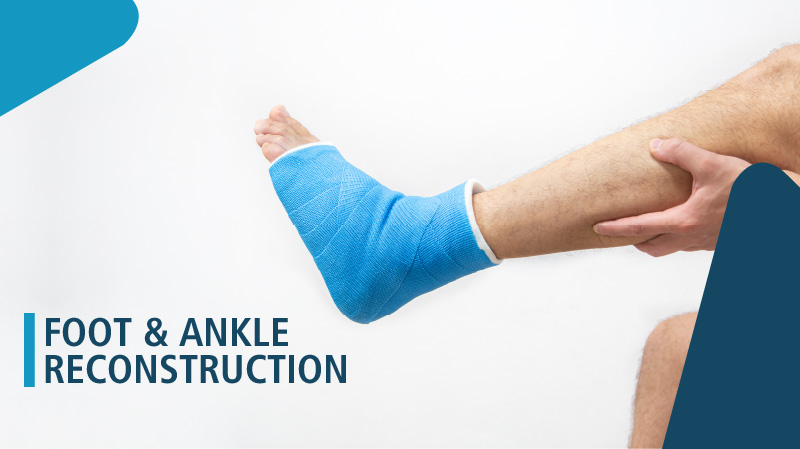 ankle injury doctor in West Delhi